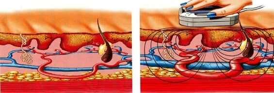 quand tes jambes s'engourdissent